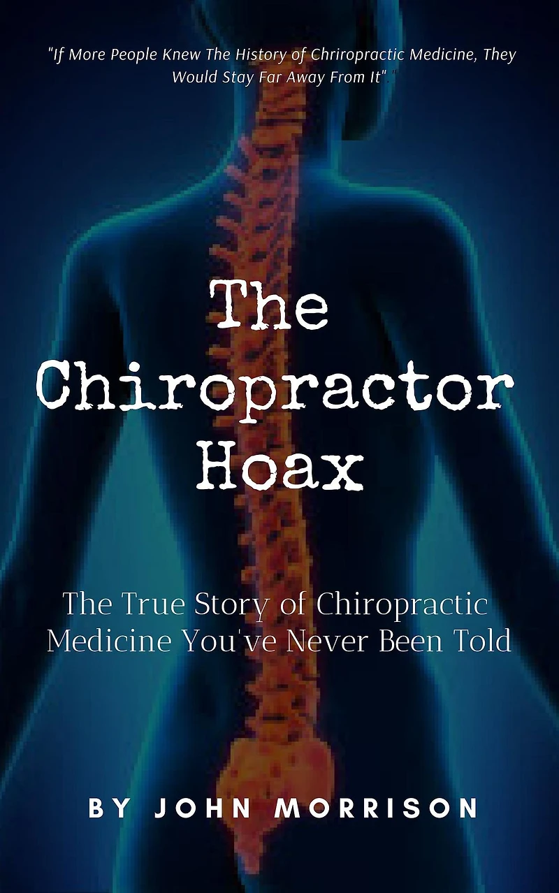 The Chiropractor Hoax: True Story of Chiropractic Medicine You've Never Been Told