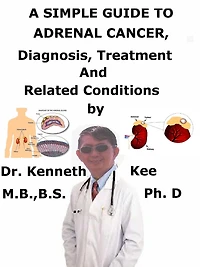 A Simple Guide to Adrenal Cancer, Diagnosis, Treatment and Related Conditions
