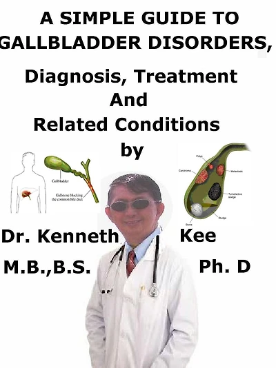 A Simple Guide to Gallbladder Disorders, Diagnosis, Treatment and Related Conditions