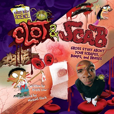 Clot & Scab: Gross Stuff about Your Scrapes, Bumps, and Bruises
