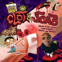 Clot & Scab: Gross Stuff about Your Scrapes, Bumps, and Bruises