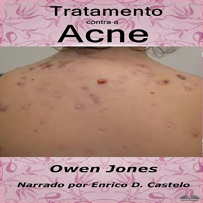 Tratamento Contra A Acne
