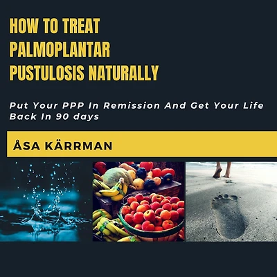 How To Treat Palmoplantar Pustulosis Naturally: Put Your PPP Remission And Get Life Back 90 days