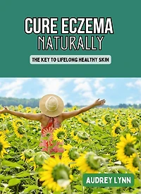 Cure Eczema Naturally - The Key to Lifelong Healthy Skin