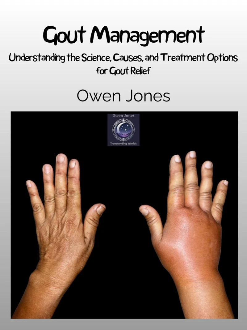Gout Management: Understanding The Science, Causes, And Treatment Options For Relief