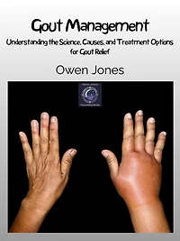 Gout Management: Understanding The Science, Causes, And Treatment Options For Relief