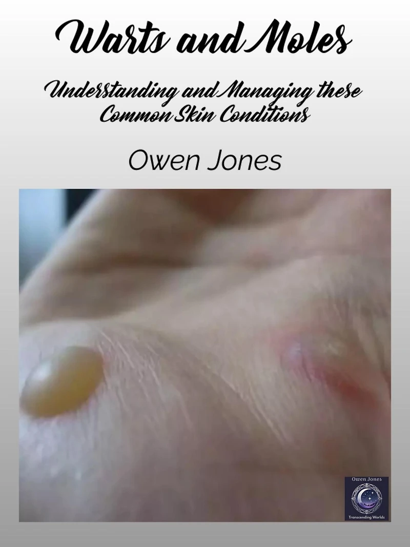 Warts And Moles: Understanding Managing These Common Skin Conditions