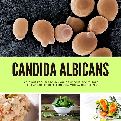 Candida Albicans: A Beginner's 5-Step to Managing the Condition Through Diet and Other Home Remedies, With Sample Recipes