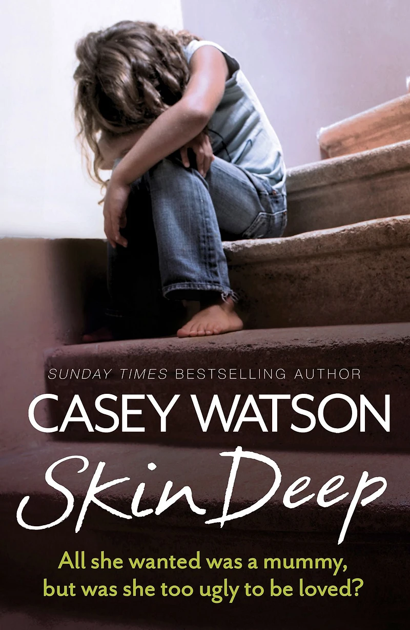 Skin Deep: All she wanted was a mummy, but too ugly to be loved?