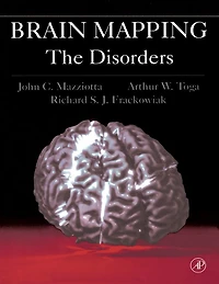 Brain Mapping: The Disorders: The Disorders