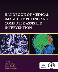 Handbook of Medical Image Computing and Computer Assisted Intervention