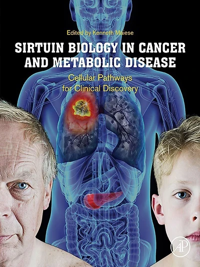 Sirtuin Biology Cancer and Metabolic Disease: Cellular Pathways for Clinical Discovery