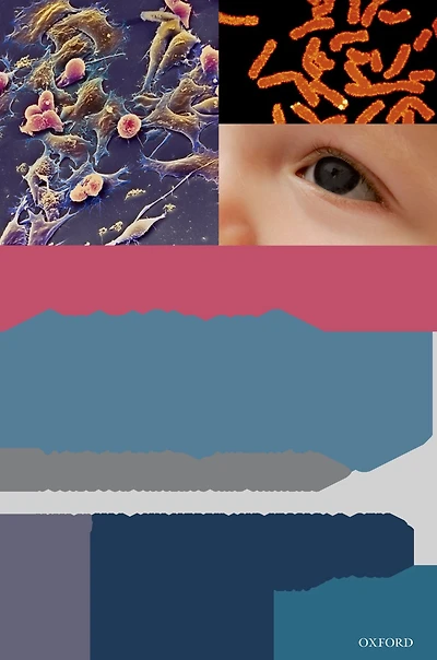 Aniridia and WAGR Syndrome: A Guide for Patients and Their Families