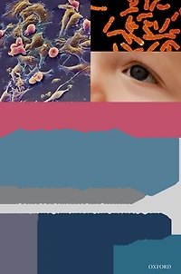 Aniridia and WAGR Syndrome: A Guide for Patients and Their Families