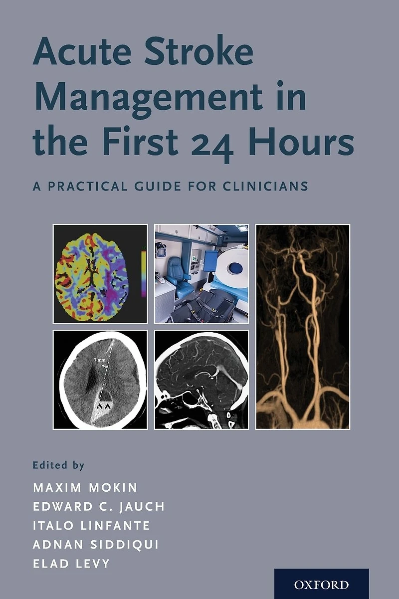 Acute Stroke Management the First 24 Hours: A Practical Guide for Clinicians