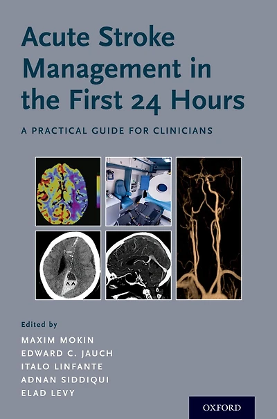 Acute Stroke Management the First 24 Hours: A Practical Guide for Clinicians