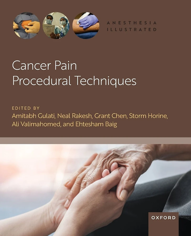 Cancer Pain Procedural Techniques