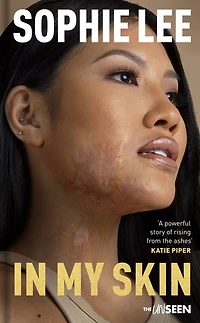 My Skin: Learning to love your perfectly imperfect life