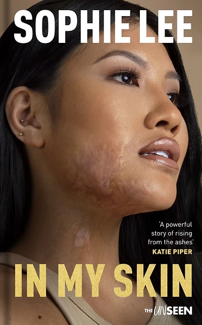 My Skin: Learning to love your perfectly imperfect life