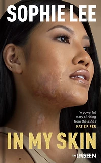 My Skin: Learning to love your perfectly imperfect life