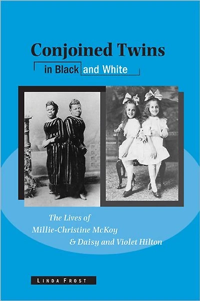 Conjoined Twins Black and White: The Lives of Millie-Christine McKoy Daisy Violet Hilton