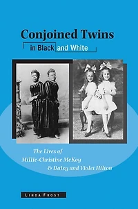 Conjoined Twins Black and White: The Lives of Millie-Christine McKoy Daisy Violet Hilton