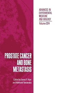 Prostate Cancer and Bone Metastasis