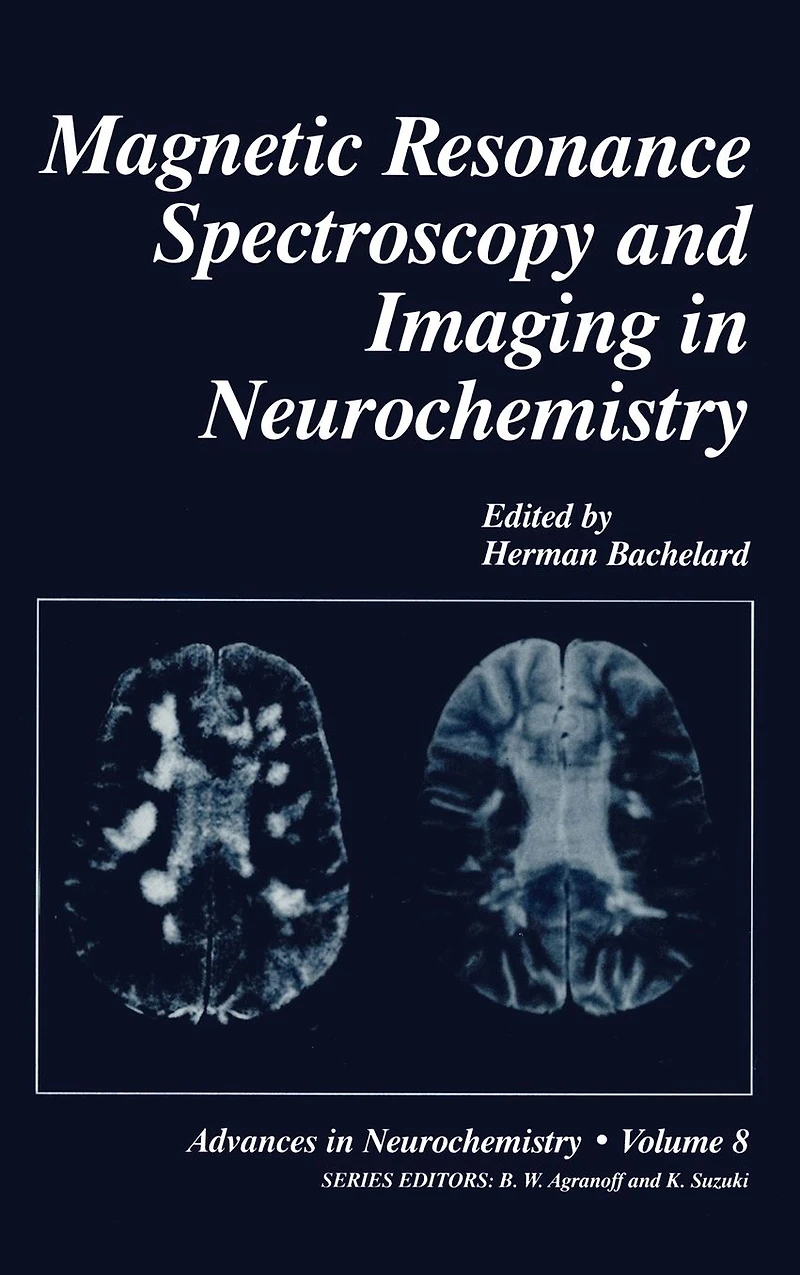 Magnetic Resonance Spectroscopy and Imaging Neurochemistry