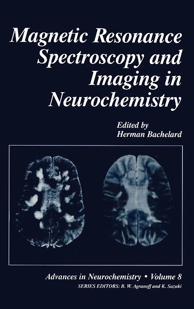 Magnetic Resonance Spectroscopy and Imaging Neurochemistry