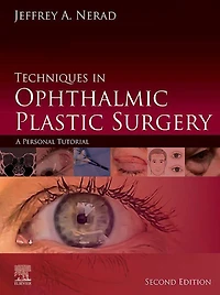 Techniques Ophthalmic Plastic Surgery: A Personal Tutorial