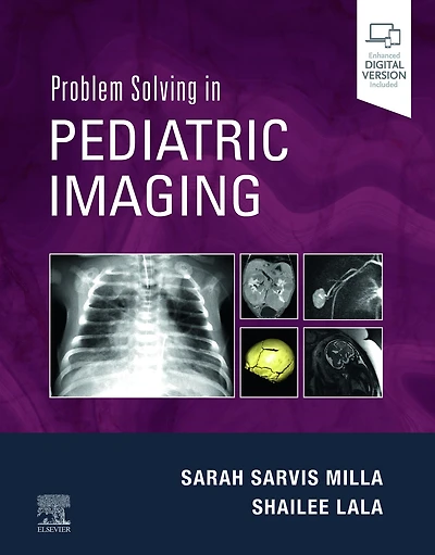 Problem Solving Pediatric Imaging