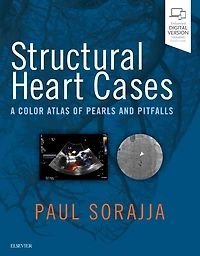 Structural Heart Cases: A Color Atlas of Pearls and Pitfalls