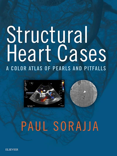 Structural Heart Cases: A Color Atlas of Pearls and Pitfalls