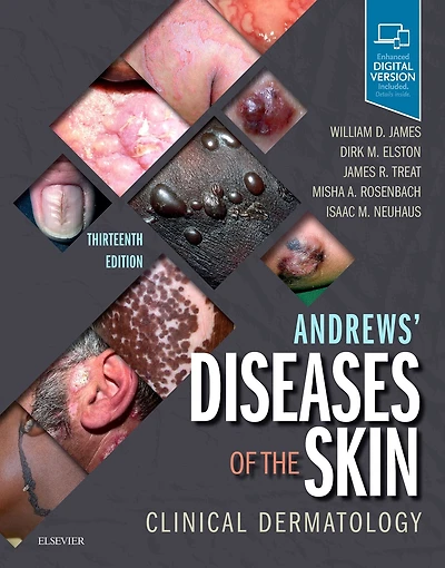 Andrews' Diseases of the Skin: Clinical Dermatology