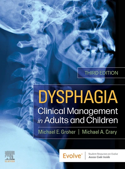 Dysphagia - E-Book: E-Book