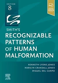 Smith's Recognizable Patterns of Human Malformation - E-Book
