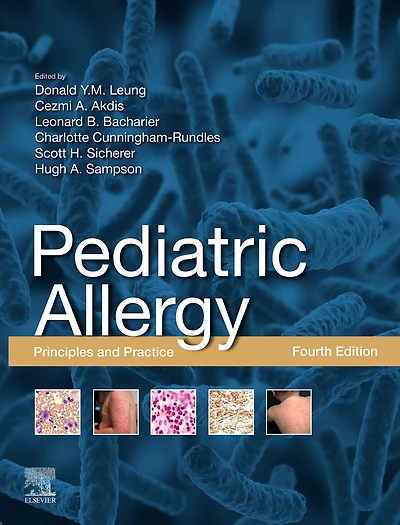 Pediatric Allergy,E-Book: Principles and Practice