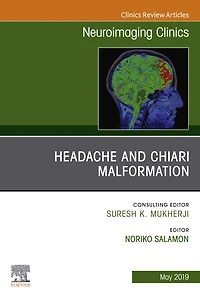 Headache and Chiari Malformation, An Issue of Neuroimaging Clinics of North America