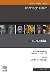 Ultrasound, An Issue of Radiologic Clinics of North America