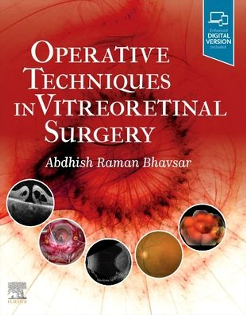 Operative Techniques Vitreoretinal Surgery E-Book