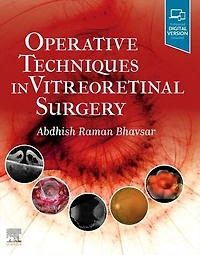 Operative Techniques Vitreoretinal Surgery E-Book