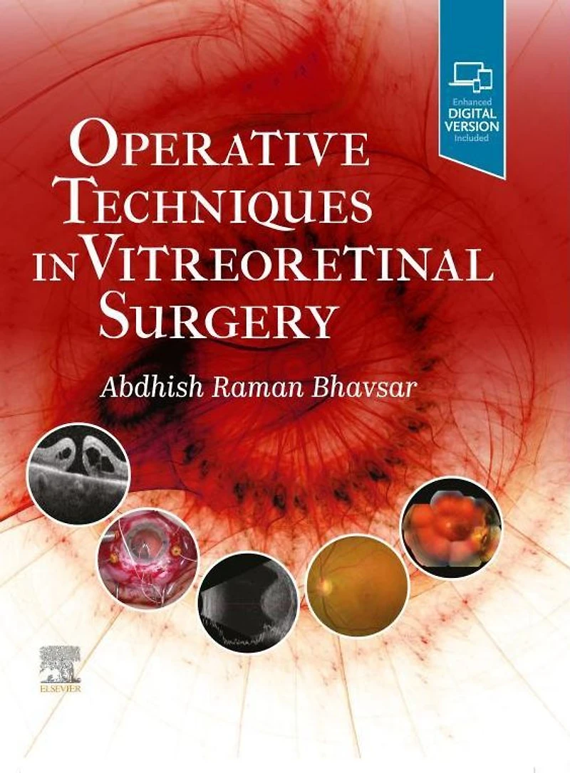 Operative Techniques Vitreoretinal Surgery E-Book