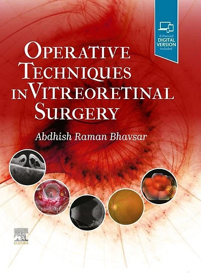 Operative Techniques Vitreoretinal Surgery E-Book