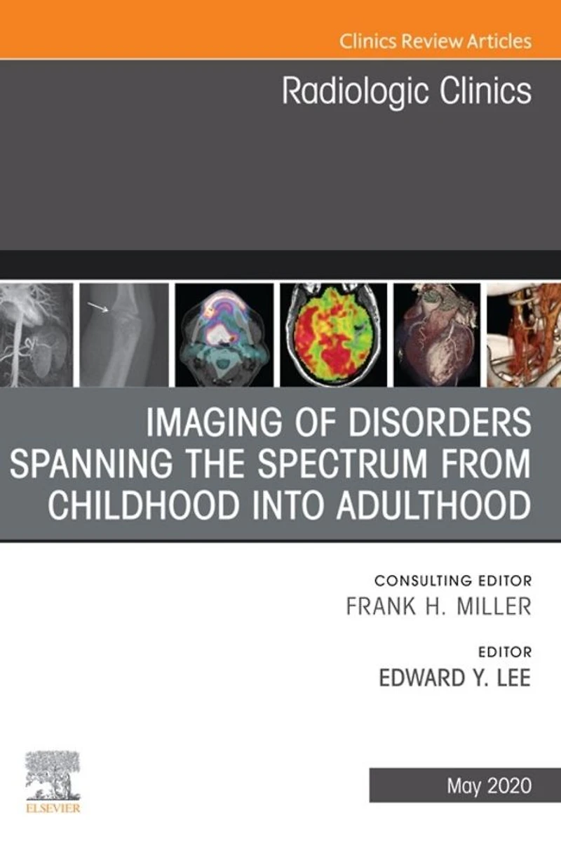 Imaging of Disorders Spanning the Spectrum from Childhood ,An Issue of Radiologic Clinics of North America E-Book: Imaging of Disorders Spanning the Spectrum from Childhood ,An Issue of Radiologic Clinics of North America E-Book