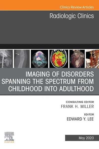 Imaging of Disorders Spanning the Spectrum from Childhood ,An Issue of Radiologic Clinics of North America E-Book: Imaging of Disorders Spanning the Spectrum from Childhood ,An Issue of Radiologic Clinics of North America E-Book
