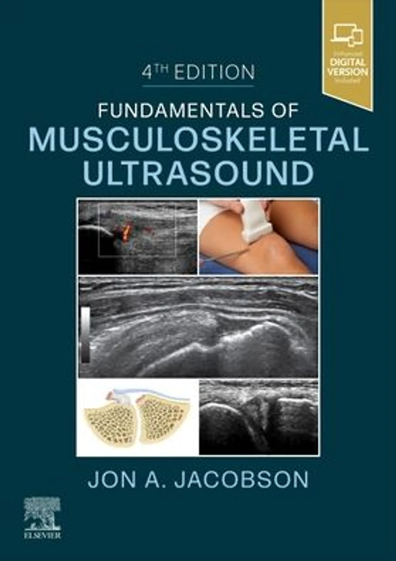 Fundamentals of Musculoskeletal Ultrasound,E-Book