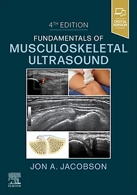 Fundamentals of Musculoskeletal Ultrasound,E-Book