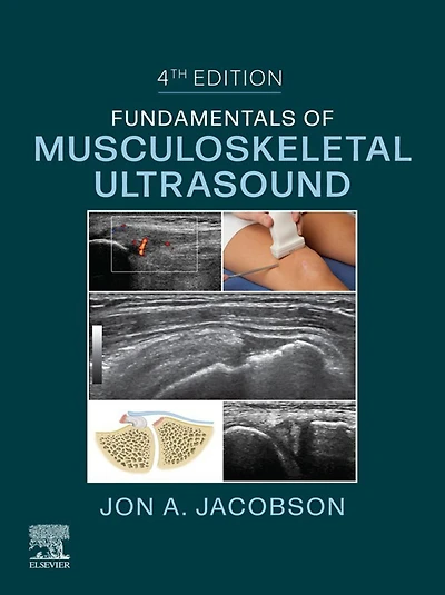 Fundamentals of Musculoskeletal Ultrasound,E-Book