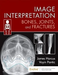 Image Interpretation: Bones, Joints, and Fractures