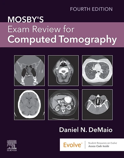 Mosby's Exam Review for Computed Tomography